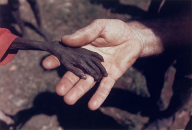 Παγκόσμια μάστιγα ο υποσιτισμός