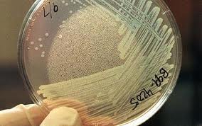 Σύσκεψη στην Κρήτη για το E.coli