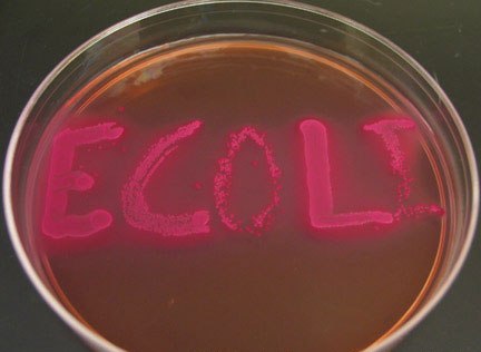 E-Coli και σε άλλα προϊόντα στη χώρα μας