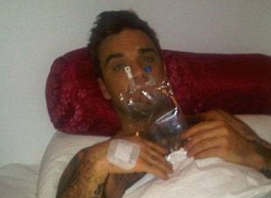 Στο κρεβάτι του πόνου ο Robbie Williams