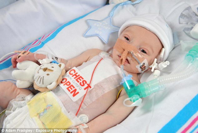 Νεογέννητο μιας ημέρας υποβλήθηκε σε επέμβαση ανοιχτής καρδιάς