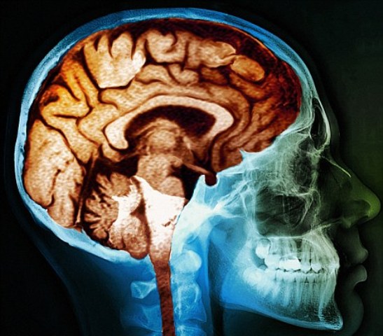 Η εγκεφαλική γήρανση είναι το τίμημα του να είσαι άνθρωπος;