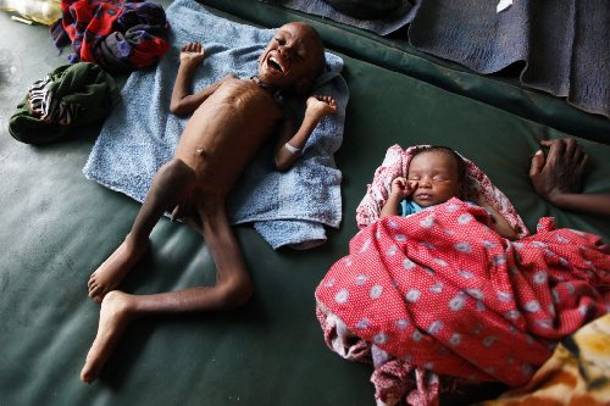 Ανελέητο το χτύπημα του λιμού στη Σομαλία