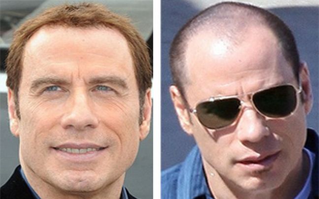 Που πήγαν τα μαλλιά σου John Travolta;