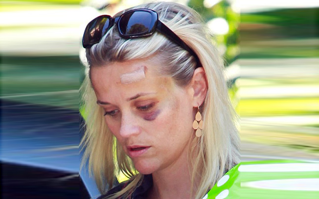 Με μαυρισμένο μάτι εμφανίστηκε η Reese Witherspoon