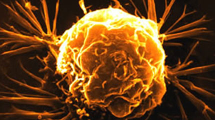 Συσκευή «μέδουσα» ανιχνεύει καρκινικά κύτταρα
