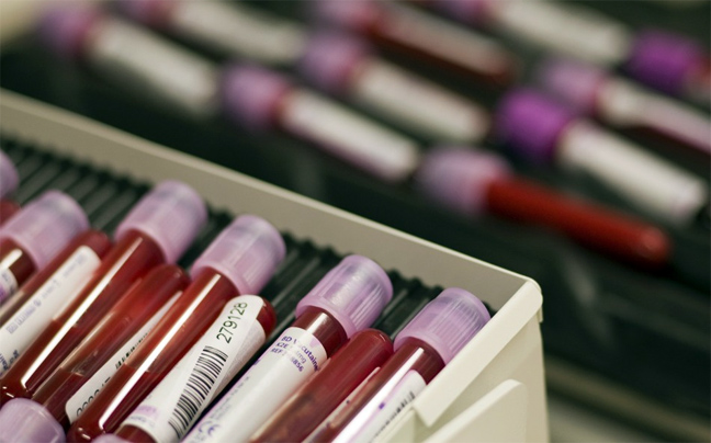 Νέο τεστ αίματος θα προβλέπει την αρθρίτιδα