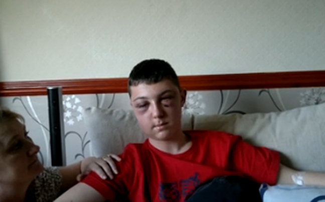 Ρατσιστική επίθεση σε 17χρονο στην Αγγλία