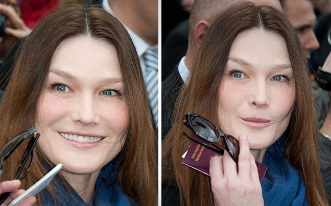 Το παράκανε με το μπότοξ η Carla Bruni