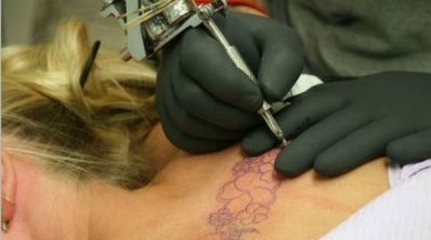 Πώς μπορούν να αφαιρεθούν τα μόνιμα τατουάζ