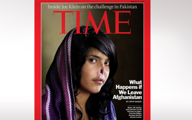 Πώς είναι σήμερα η μικρή Αφγανή που ακρωτηριάστηκε για να τιμωρηθεί