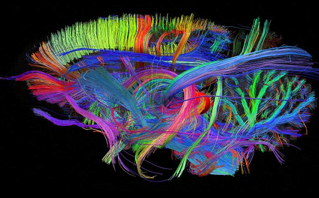 Τρισδιάστατος «χάρτης» του ανθρώπινου εγκεφάλου