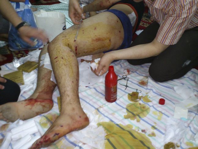 Στην Τουρκία τραυματισμένοι Σύροι