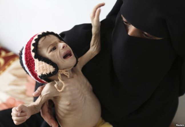 Πεινάνε 12 εκατ. κάτοικοι της Υεμένης