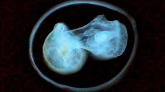 Στα αζήτητα χιλιάδες κατεψυγμένα έμβρυα
