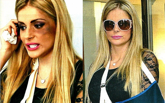 Ιταλίδα ηθοποιός καταγγέλλει ότι έπεσε θύμα ξυλοδαρμού