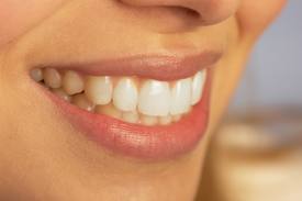 Λευκαντικό για τα δόντια εξαφανίζει τους λεκέδες