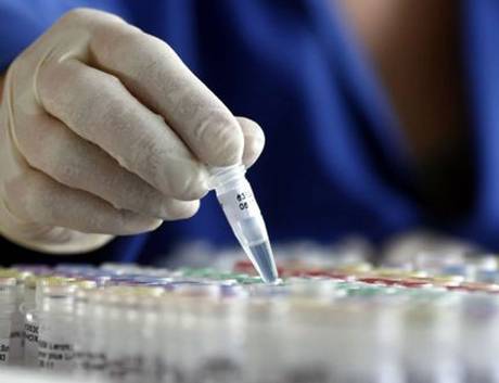 Πέντε ιοί πιο θανατηφόροι από τον Έμπολα