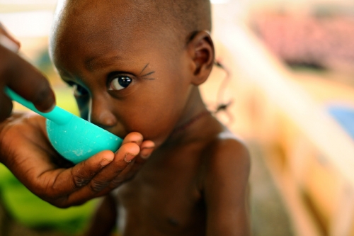 Τουλάχιστον 362 παιδιά πέθαναν από υποσιτισμό στον Νίγηρα