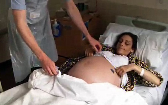 Η «έγκυος» που πάσχει από κίρρωση του ήπατος