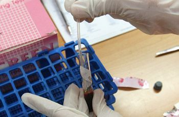 Δωρεάν τεστ για τον ιό ΗΙV στην Θεσσαλονίκη