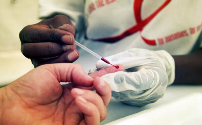 Άμεση φαρμακευτική αγωγή μετά τη διάγνωση HIV μειώνει τη θνησιμότητα