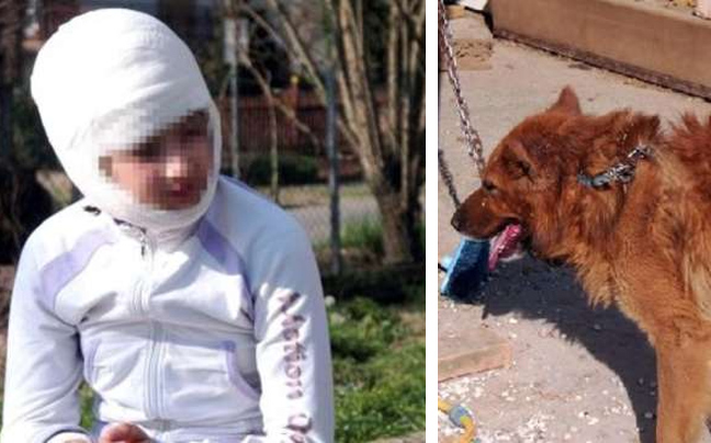 Σκύλος επιτέθηκε σε κοριτσάκι 11 ετών
