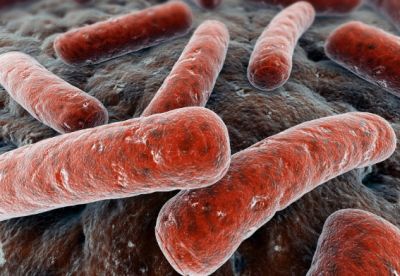 Σύστημα τεχνητής νοημοσύνης κάνει διαγνώσεις φυματίωσης
