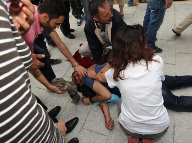 Νεκρός 30χρονος Τούρκος που πυροβολήθηκε στο κεφάλι από την αστυνομία
