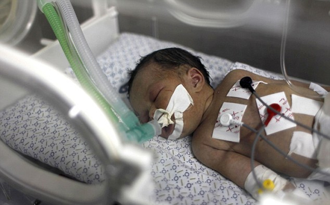 Μάχη για να κρατηθεί στη ζωή δίνει το μωρό-θαύμα της Γάζας
