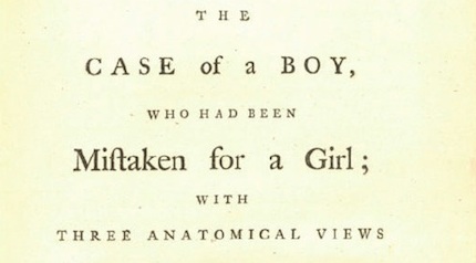 Η ιστορία μιας επέμβασης «αλλαγής φύλου» το 18ο αιώνα