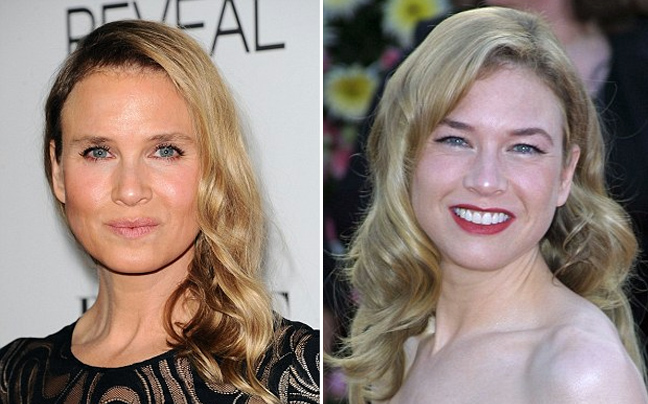 Κι όμως είναι η Renee Zellweger