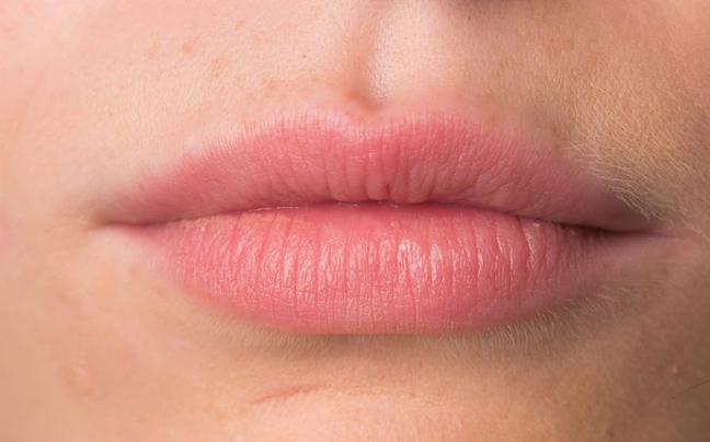Πώς να απαλύνετε τα σκασμένα χείλη