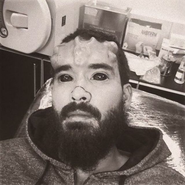 Ίσως η πιο φρικτή επέμβαση σε πρόσωπο