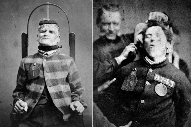 Τρομακτικά πορτραίτα ψυχικά ασθενών τον 19ο αιώνα