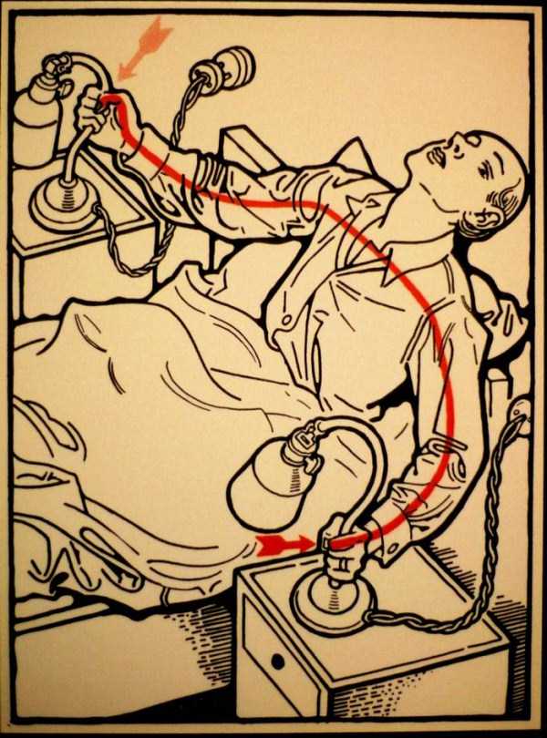 how-we-can-die-by-electrocution-22