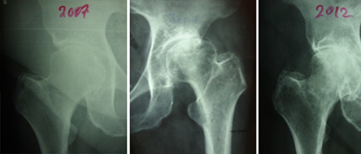 proto_deutero_trito_stadio proto_deutero_trito_stadio