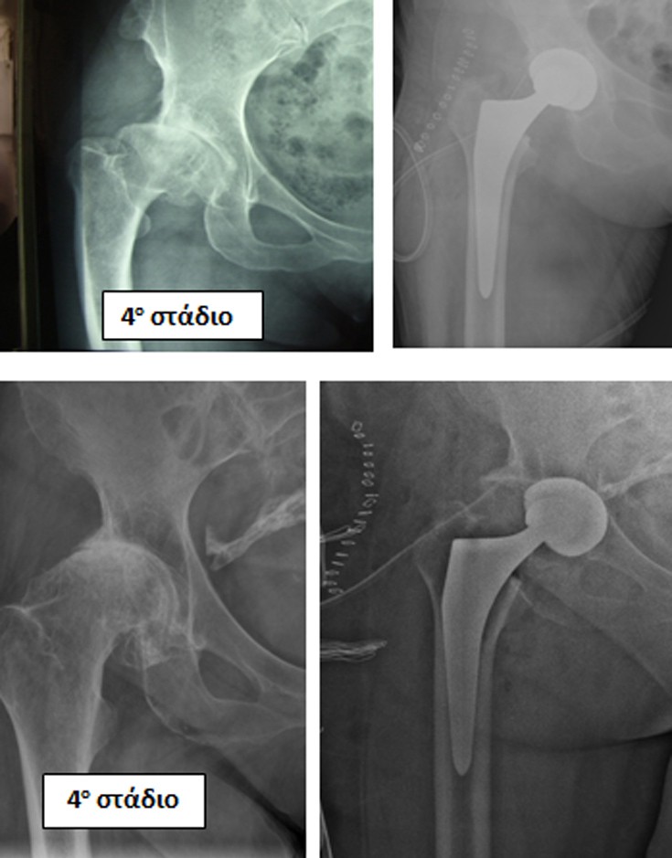 tetarto_stadio tetarto_stadio