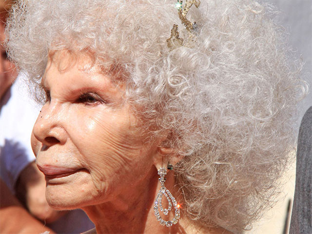 plastic_surgery_fails_13