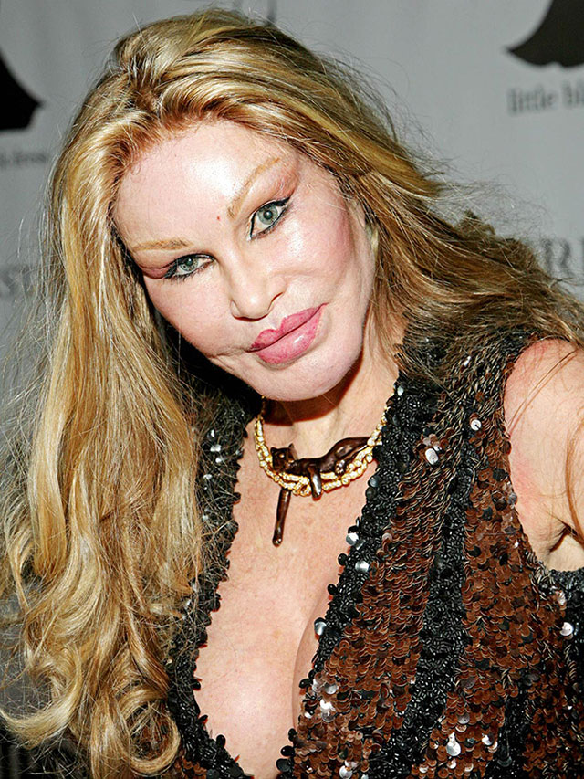 plastic_surgery_fails_16