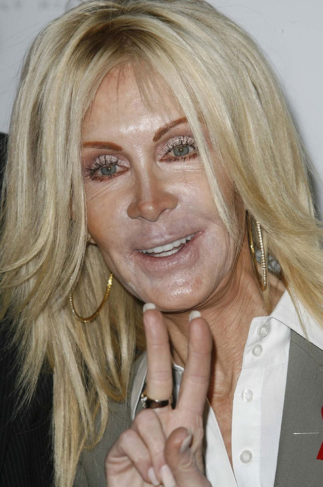 plastic_surgery_fails_7