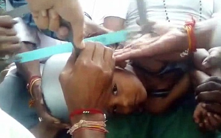 Επτάχρονος «σφήνωσε» με το κεφάλι σε χύτρα