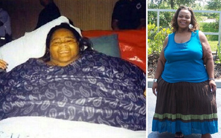 Η παχύτερη γυναίκα στον κόσμο έχασε… 230 κιλά!