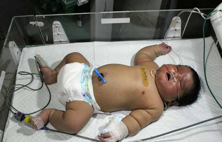 Το πιο βαρύ νεογέννητο της Ινδίας