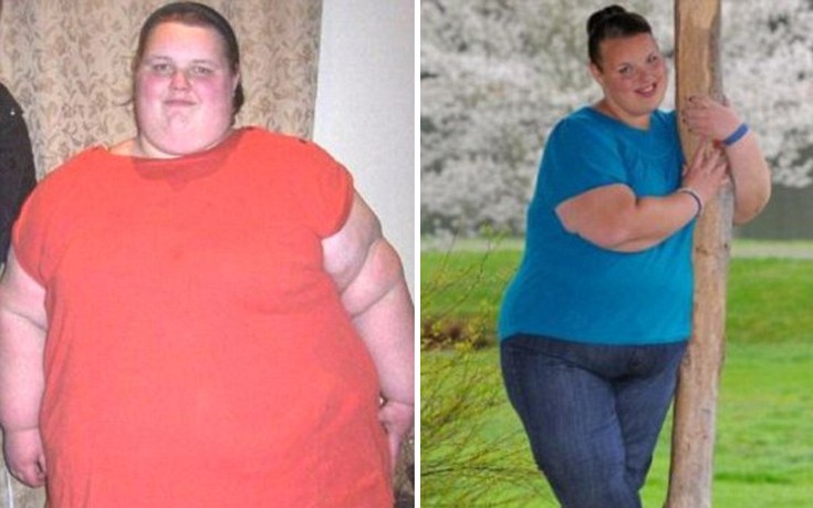 Η κάποτε «παχύτερη έφηβη της Βρετανίας» έχασε 130 κιλά