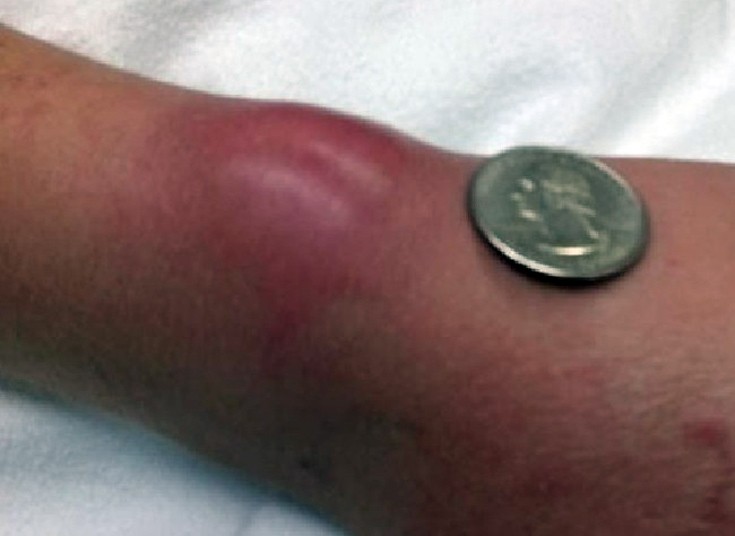 lastixajsdam2 lastixajsdam2