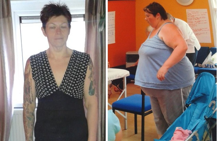Η γυναίκα που έχασε σχεδόν το μισό της βάρος