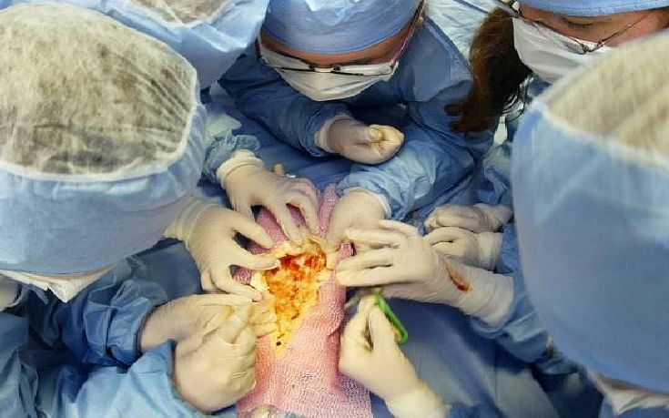 Έξι παράξενα πράγματα που συνέβησαν μετά από εγχειρήσεις
