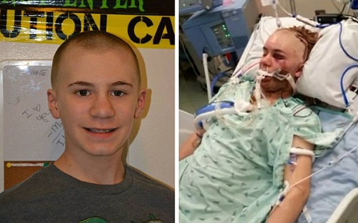 Δεκατετράχρονος τραυματίστηκε σοβαρά στη θανατηφόρα τρέλα των εφήβων