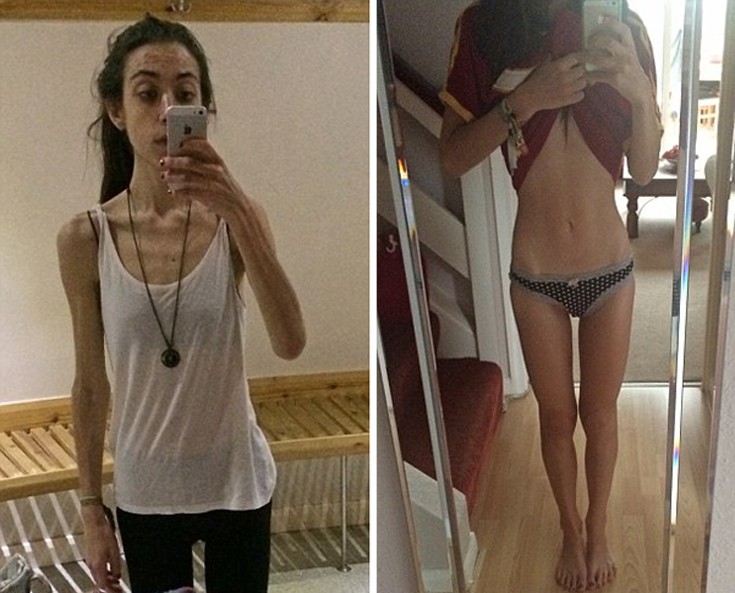 kaisdapdpio2 kaisdapdpio2